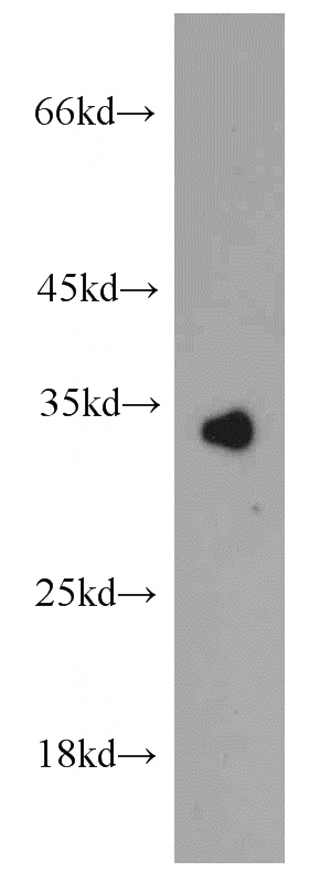 mouse liver tissue were subjected to SDS PAGE followed by western blot with Catalog No:109374(COLEC11 antibody) at dilution of 1:500
