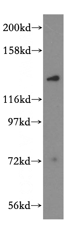 mouse brain tissue were subjected to SDS PAGE followed by western blot with Catalog No:112982(MYO1A antibody) at dilution of 1:500