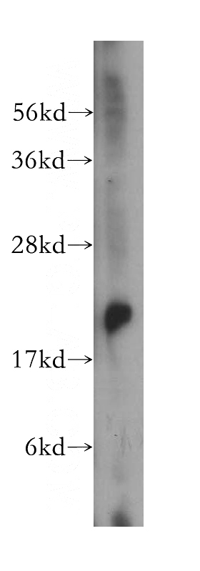 human brain tissue were subjected to SDS PAGE followed by western blot with Catalog No:114413(RAB14 antibody) at dilution of 1:500