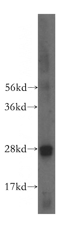 human colon tissue were subjected to SDS PAGE followed by western blot with Catalog No:114431(RAB32 antibody) at dilution of 1:500
