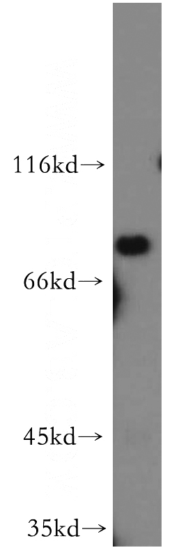 mouse kidney tissue were subjected to SDS PAGE followed by western blot with Catalog No:117034(ZDHHC5 antibody) at dilution of 1:500