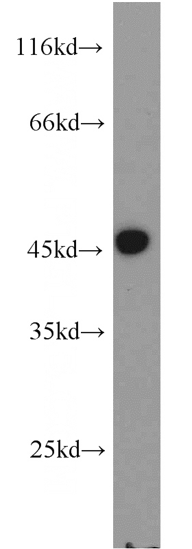 HEK-293 cells were subjected to SDS PAGE followed by western blot with Catalog No:113917(PIP5KL1 antibody) at dilution of 1:500