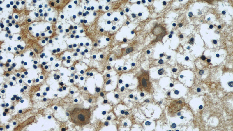 Immunohistochemical of paraffin-embedded human cerebellum using Catalog No:107323(NCALD antibody) at dilution of 1:50 (under 40x lens)