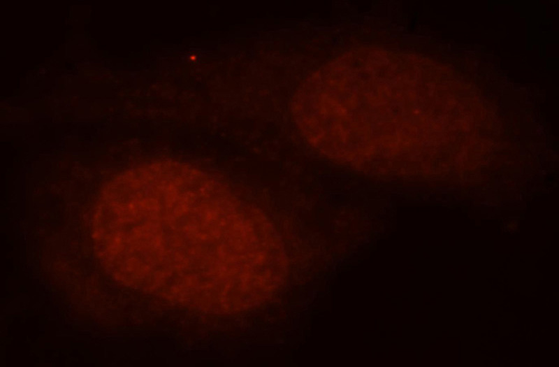 Immunofluorescent analysis of MCF-7 cells, using HEXIM1 antibody Catalog No:111304 at 1:25 dilution and Rhodamine-labeled goat anti-rabbit IgG (red).