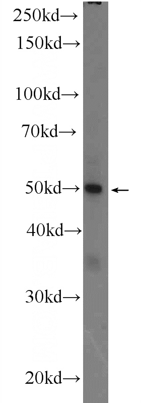 MCF-7 cells were subjected to SDS PAGE followed by western blot with Catalog No:116947(ZNF134 Antibody) at dilution of 1:600