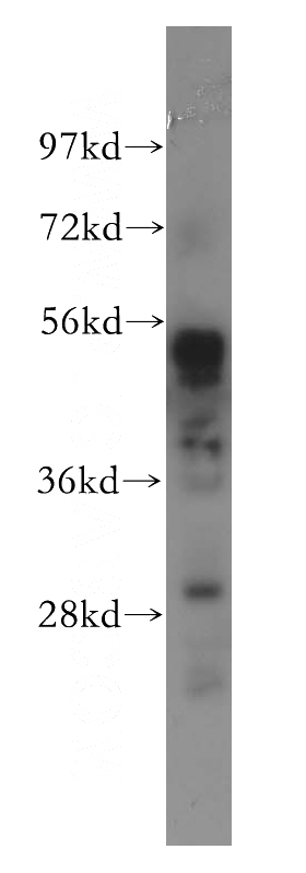 HEK-293 cells were subjected to SDS PAGE followed by western blot with Catalog No:115281(SHPK antibody) at dilution of 1:500