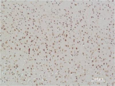 Immunohistochemical analysis of paraffin-embedded  Rat Brain Tissue using NFkB p65 Mouse mAb diluted at 1:500.