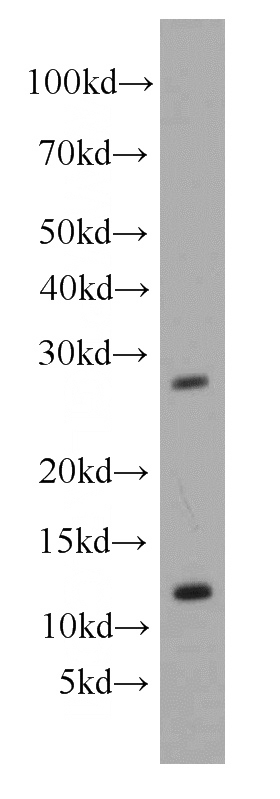 mouse liver tissue were subjected to SDS PAGE followed by western blot with Catalog No:111225(GSX1 antibody) at dilution of 1:500