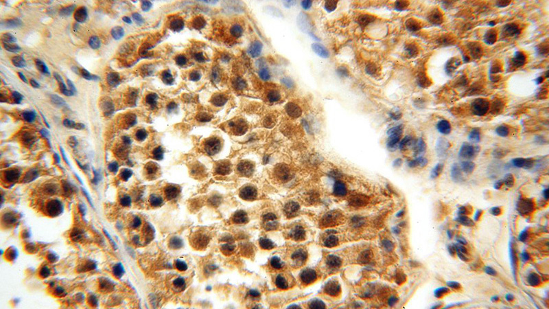 Immunohistochemical of paraffin-embedded human testis using Catalog No:108028(APOBEC4 antibody) at dilution of 1:50 (under 40x lens)