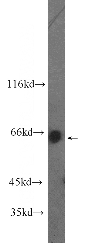 HepG2 cells were subjected to SDS PAGE followed by western blot with Catalog No:112688(MLXIPL antibody) at dilution of 1:1000