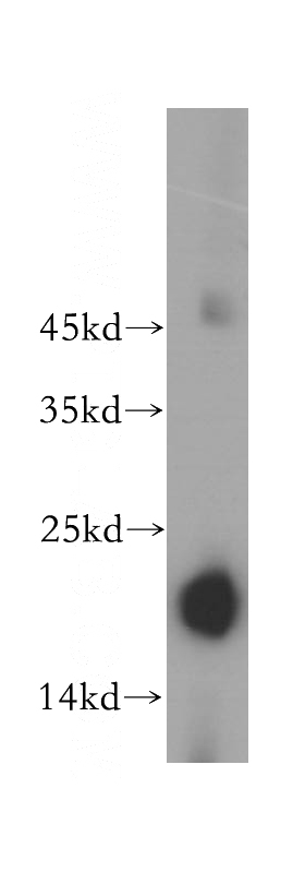 mouse kidney tissue were subjected to SDS PAGE followed by western blot with Catalog No:114286(Prx5 antibody) at dilution of 1:600
