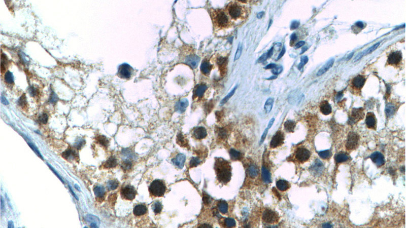Immunohistochemistry of paraffin-embedded human testis tissue slide using Catalog No:109666(CCNE2 Antibody) at dilution of 1:50 (under 40x lens).