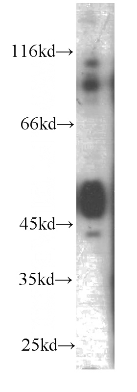 human brain tissue were subjected to SDS PAGE followed by western blot with Catalog No:107631(TNFR1 antibody) at dilution of 1:1000
