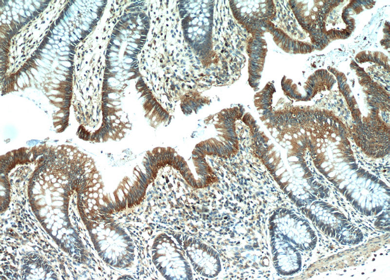 Immunohistochemical of paraffin-embedded human colon using Catalog No:112149(LARS antibody) at dilution of 1:100 (under 10x lens)