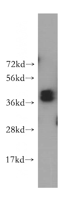 HeLa cells were subjected to SDS PAGE followed by western blot with Catalog No:111504(HNRNPD antibody) at dilution of 1:500