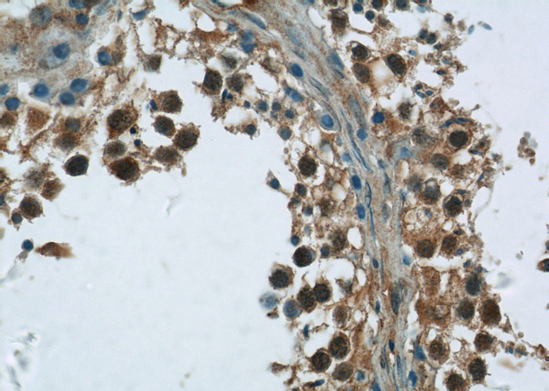 Immunohistochemistry of paraffin-embedded human testis tissue slide using Catalog No:108085(ANKS1B Antibody) at dilution of 1:50 (under 40x lens)
