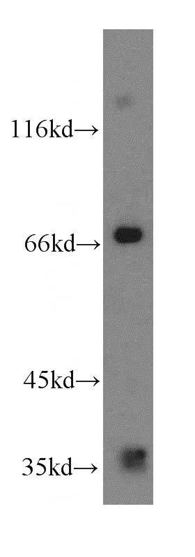 mouse brain tissue were subjected to SDS PAGE followed by western blot with Catalog No:110281(ELL2 antibody) at dilution of 1:400
