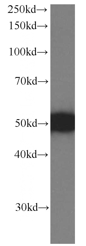 HeLa cells were subjected to SDS PAGE followed by western blot with Catalog No:107489(PSMD4 Antibody) at dilution of 1:1000