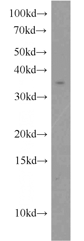 K-562 cells were subjected to SDS PAGE followed by western blot with Catalog No:116365(TSPAN7 antibody) at dilution of 1:300