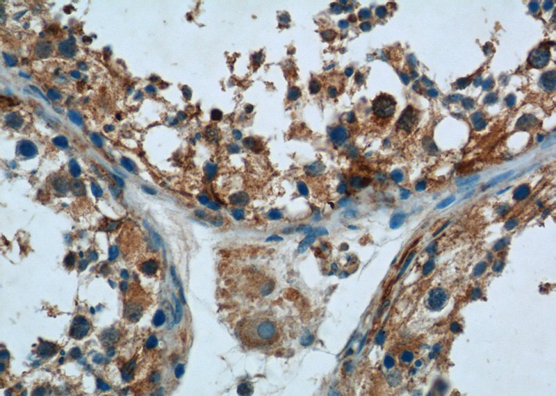 Immunohistochemistry of paraffin-embedded human testis tissue slide using Catalog No:116187(TMEM38B Antibody) at dilution of 1:50 (under 40x lens)