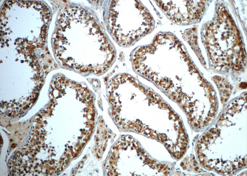 Immunohistochemistry of paraffin-embedded human testis slide using Catalog No:107962(ALDH1B1 Antibody) at dilution of 1:50