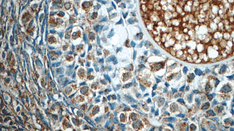 Immunohistochemistry of paraffin-embedded human ovary tissue slide using Catalog No:110584(FAM20C Antibody) at dilution of 1:50 (under 40x lens)