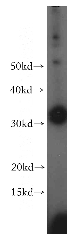 human brain tissue were subjected to SDS PAGE followed by western blot with Catalog No:116282(TMX2 antibody) at dilution of 1:500
