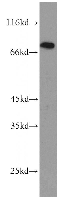 Jurkat cells were subjected to SDS PAGE followed by western blot with Catalog No:111212(ADRBK1 antibody) at dilution of 1:1000