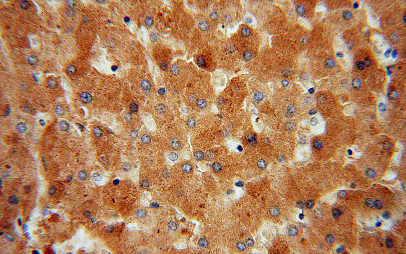 Immunohistochemical of paraffin-embedded human liver using Catalog No:107727(ACAT1 antibody) at dilution of 1:100 (under 40x lens)