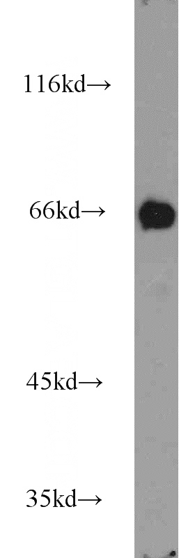 Jurkat cells were subjected to SDS PAGE followed by western blot with Catalog No:113459(OAS2 antibody) at dilution of 1:500