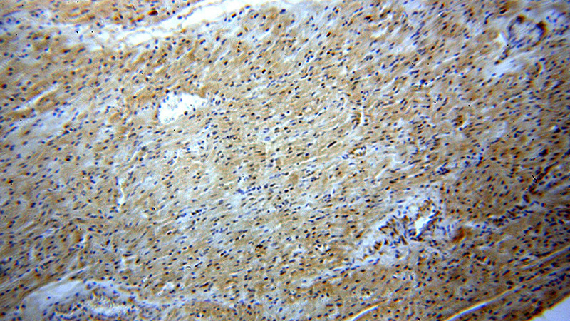 Immunohistochemical of paraffin-embedded human heart using Catalog No:109968(DNMT3A antibody) at dilution of 1:50 (under 10x lens)