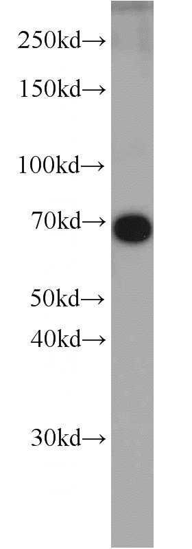 HeLa cells were subjected to SDS PAGE followed by western blot with Catalog No:112254(KU70,XRCC6 antibody) at dilution of 1:1000