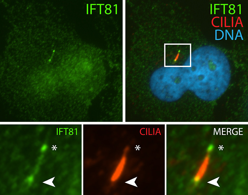 IF result (the base and tip of cilia) of anti-IFT81 (Catalog No:111673, 1:50) with serum-starved hTERT-RPE1 (PFA fixed) by Dr. Moshe Kim.