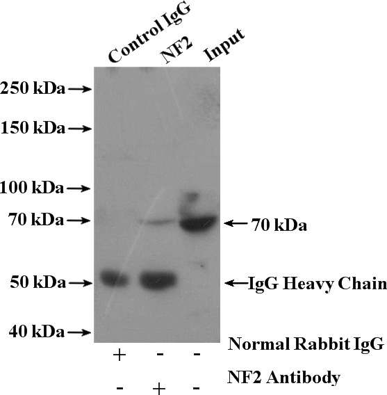 IP Result of anti-NF2 (IP:Catalog No:113136, 4ug; Detection:Catalog No:113136 1:600) with HeLa cells lysate 2400ug.