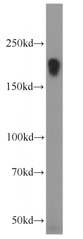 human skeletal muscle tissue were subjected to SDS PAGE followed by western blot with Catalog No:112221(LIFR antibody) at dilution of 1:800