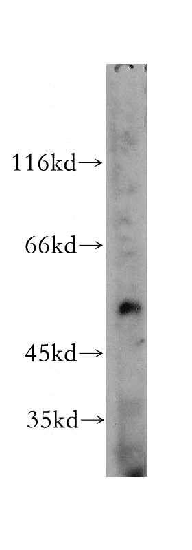 mouse spleen tissue were subjected to SDS PAGE followed by western blot with Catalog No:116143(TIN2 antibody) at dilution of 1:200