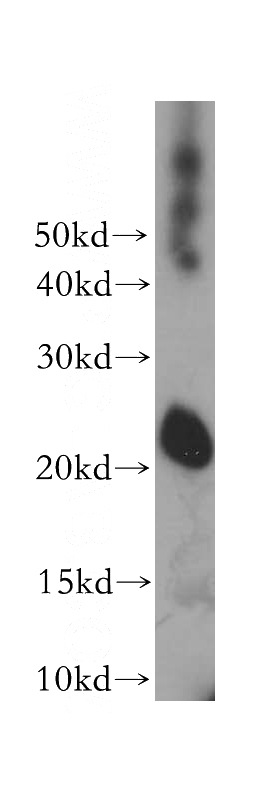 human brain tissue were subjected to SDS PAGE followed by western blot with Catalog No:115896(RHOQ antibody) at dilution of 1:300