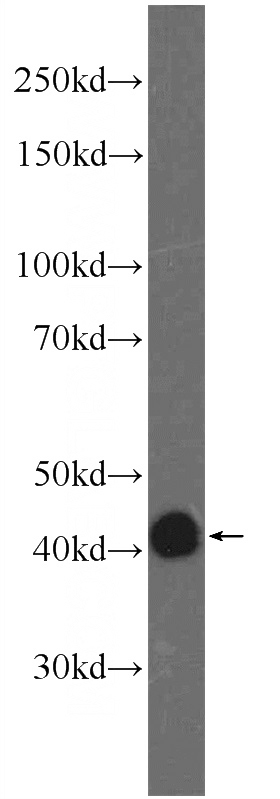PC-3 cells were subjected to SDS PAGE followed by western blot with Catalog No:110598(FAM71F2 Antibody) at dilution of 1:2000