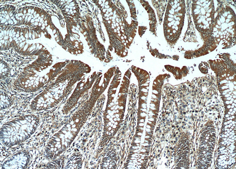Immunohistochemical of paraffin-embedded human colon using Catalog No:114203(PRKG2 antibody) at dilution of 1:50 (under 10x lens)
