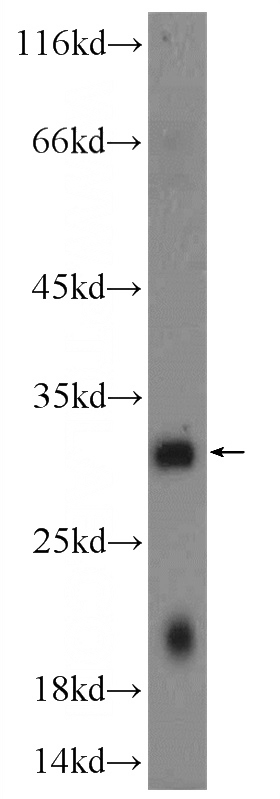 ROS1728 cells were subjected to SDS PAGE followed by western blot with Catalog No:108565(C10orf58 Antibody) at dilution of 1:300