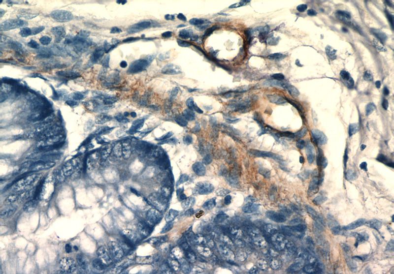 Immunohistochemistry of paraffin-embedded human colon tissue slide using Catalog No:115286(SIDT1 Antibody) at dilution of 1:50 (under 40x lens)