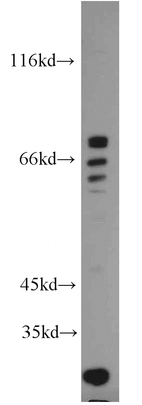 MCF7 cells were subjected to SDS PAGE followed by western blot with Catalog No:108291(ATG16L1 antibody) at dilution of 1:1000