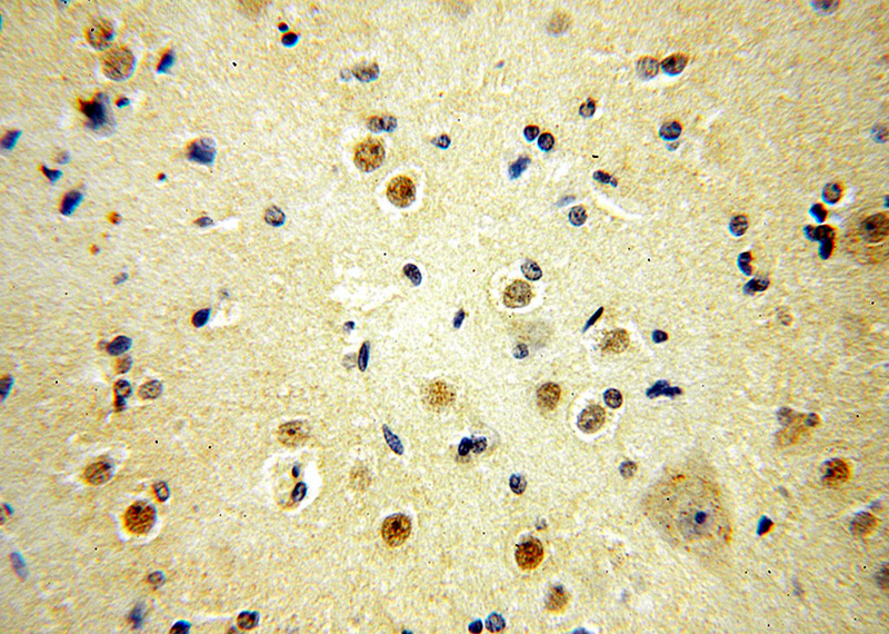 Immunohistochemical of paraffin-embedded human brain using Catalog No:112772(MTF2 antibody) at dilution of 1:50 (under 40x lens)