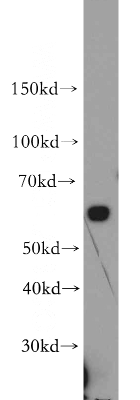 HEK-293 cells were subjected to SDS PAGE followed by western blot with Catalog No:117060(SLC39A4 antibody) at dilution of 1:500