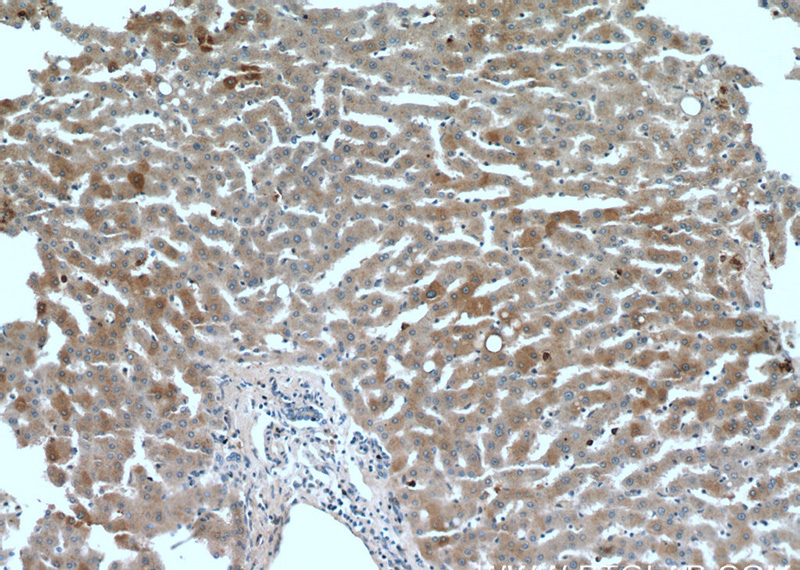 Immunohistochemistry of paraffin-embedded human liver tissue slide using Catalog No:113346(OMA1 Antibody) at dilution of 1:200 (under 10x lens).