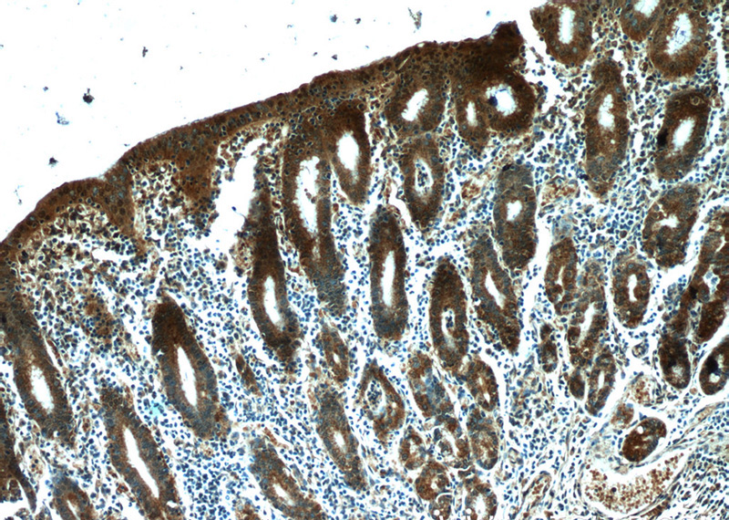 Immunohistochemistry of paraffin-embedded human stomach slide using Catalog No:113377(NUP205 Antibody) at dilution of 1:50