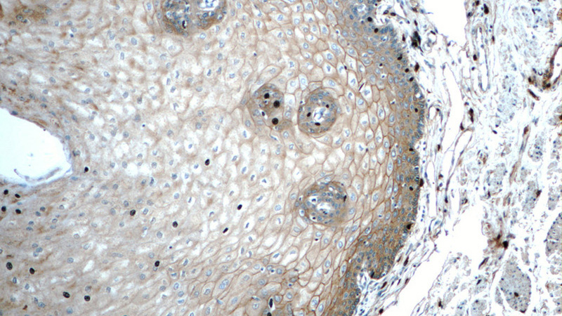 Immunohistochemistry of paraffin-embedded human oesophagus tissue slide using Catalog No:110985(GJB6 Antibody) at dilution of 1:50 (under 10x lens)