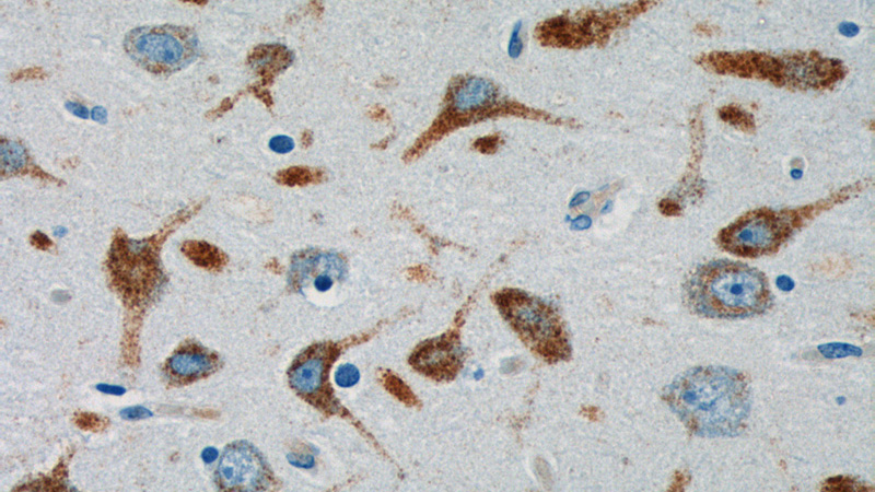 Immunohistochemistry of paraffin-embedded human brain tissue slide using Catalog No:110719(FPR2 Antibody) at dilution of 1:200 (under 40x lens).