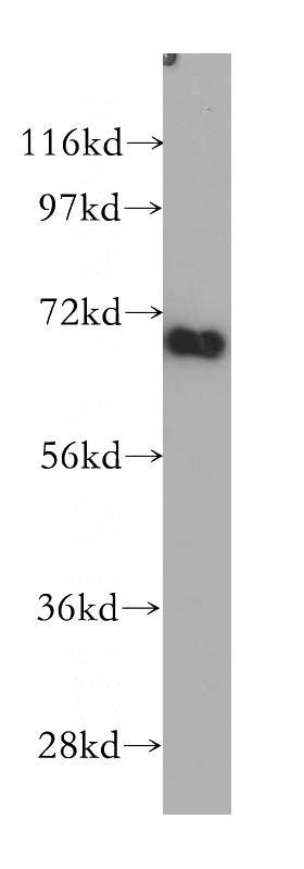 HEK-293 cells were subjected to SDS PAGE followed by western blot with Catalog No:109345(CLCNKA antibody) at dilution of 1:500