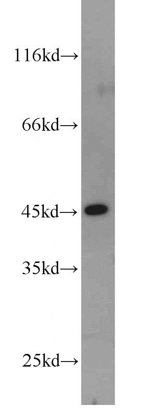 HepG2 cells were subjected to SDS PAGE followed by western blot with Catalog No:110538(FBLIM1 antibody) at dilution of 1:500